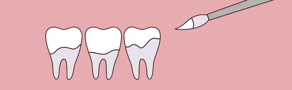| GT Dental Centre: Cosmetic and Family Dentist in Whitby