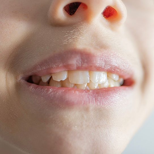 | GT Dental Centre: Cosmetic and Family Dentist in Whitby